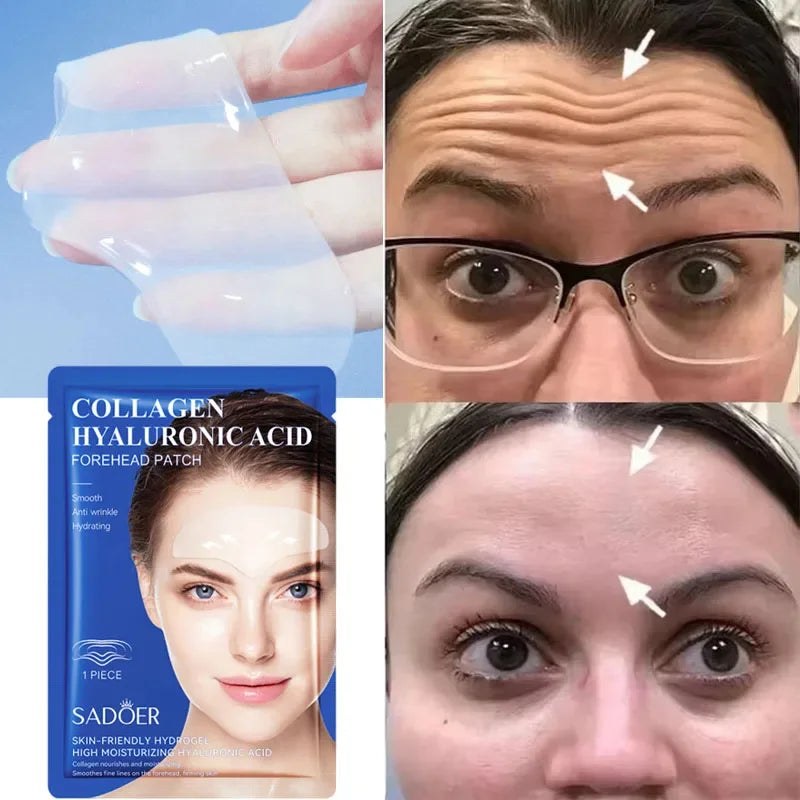 GlowUp™ - Patch Effet Botox 8h - Anti-Rides Front Collagène